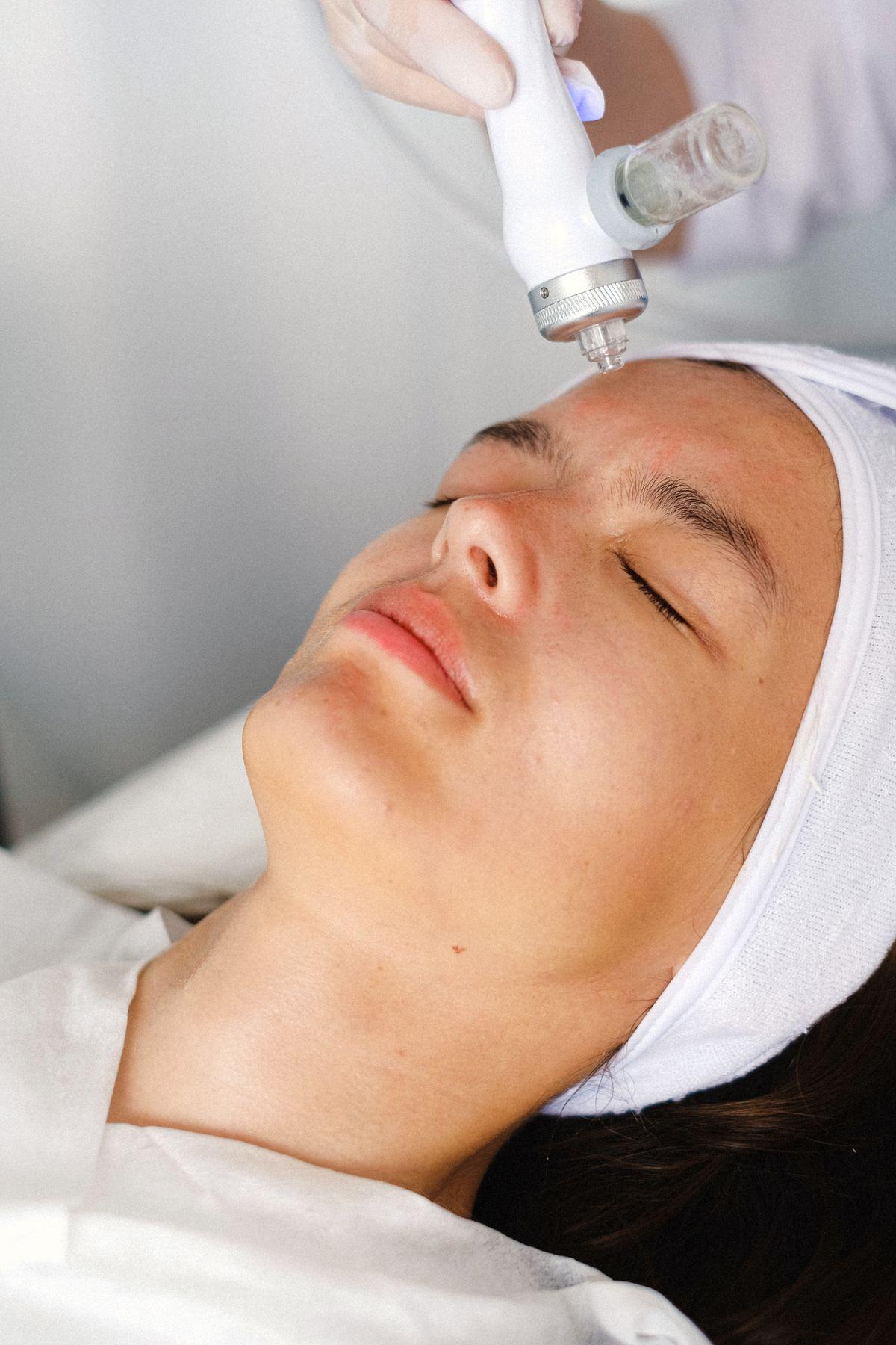 Microneedling